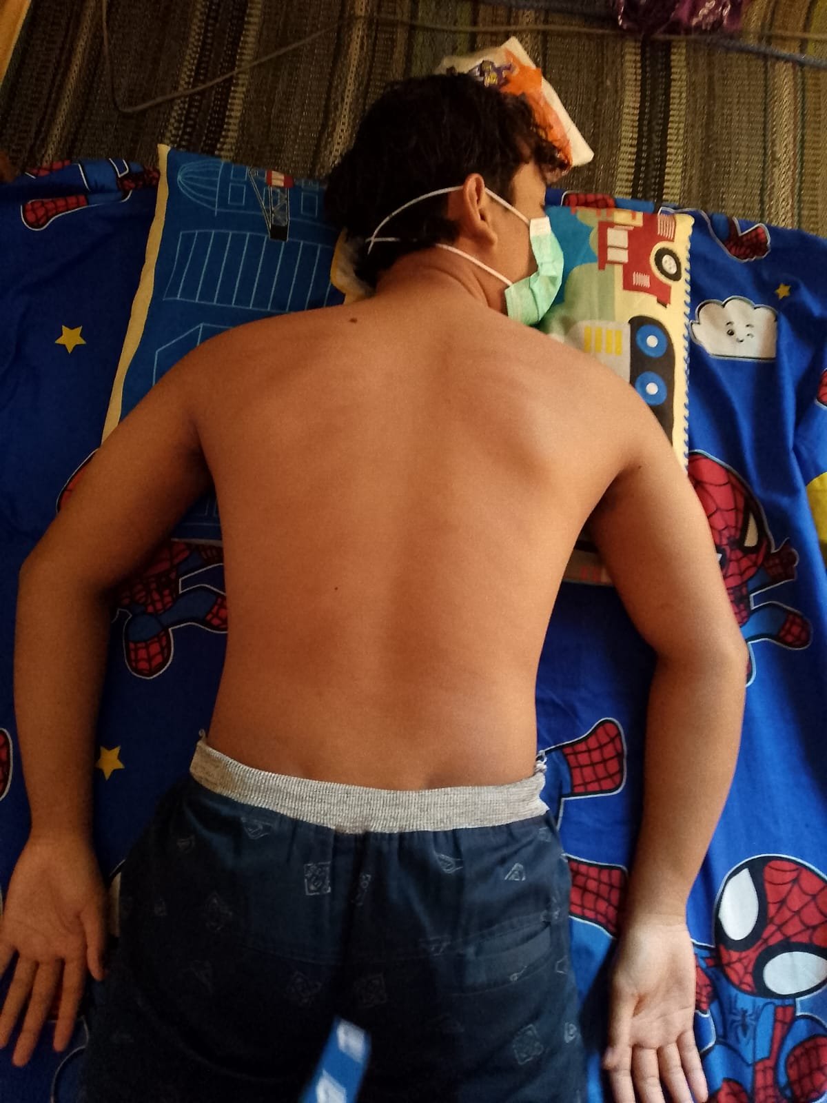 Pasien mengikuti sesi terapi pijat punggung